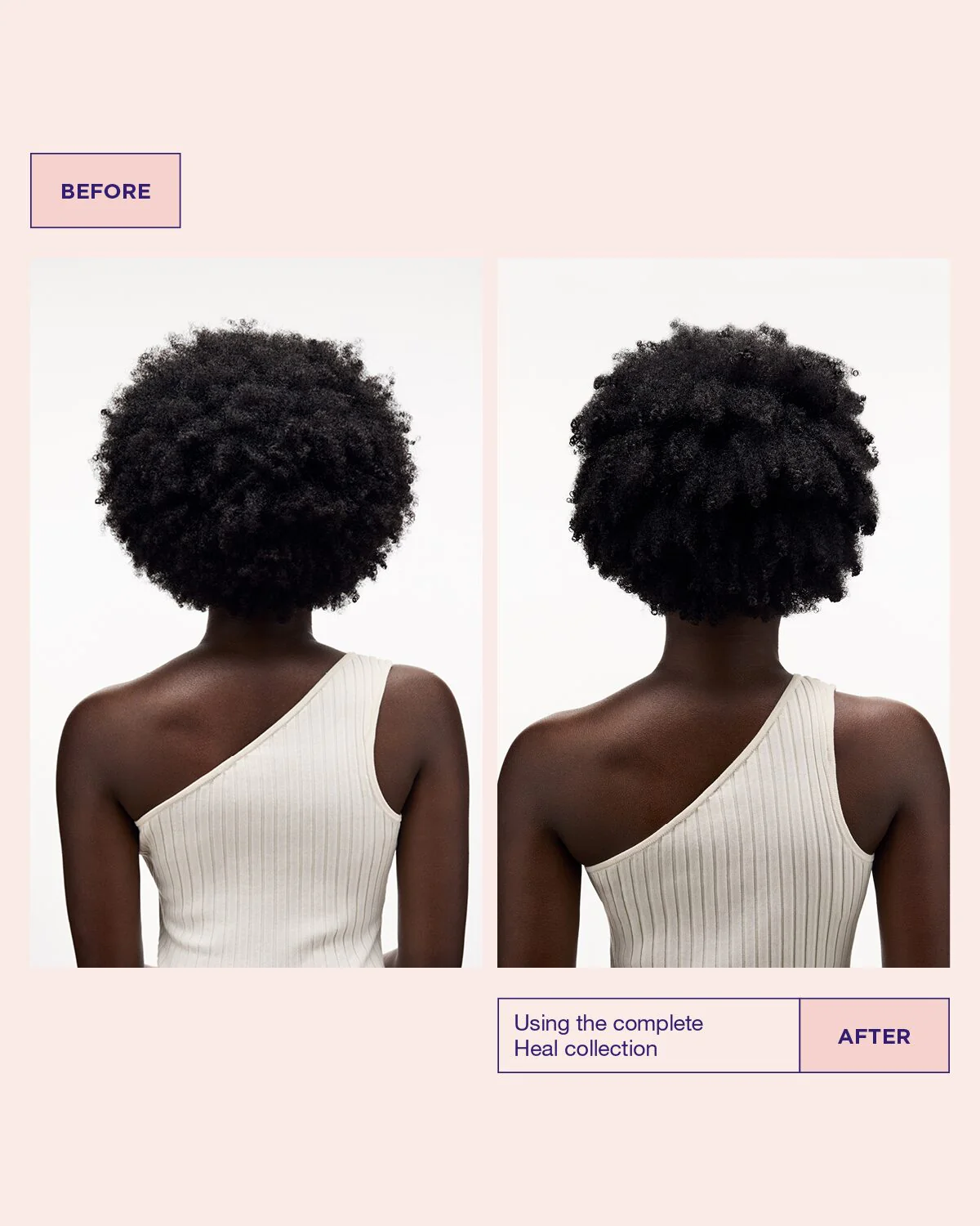 Sensitive Scalp Set - Image 13